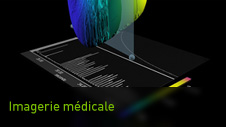 Imagerie médicale