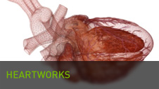 Heartworks