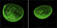Rendu volumétrique du scanner mammographique à ultrasons de TechniScan
